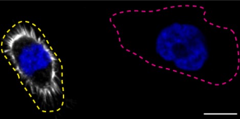 Immunocytochemistry/ Immunofluorescence - Anti-Moesin antibody [EPR2428(2)] (AB151542), expandable thumbnail