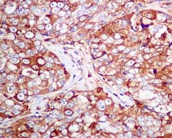 Immunohistochemistry (Formalin/PFA-fixed paraffin-embedded sections) - Anti-Moesin antibody [EPR2428(2)] (ab151542), expandable thumbnail