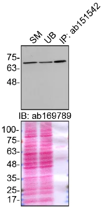 Immunoprecipitation - Anti-Moesin antibody [EPR2428(2)] - BSA and Azide free (AB246835)