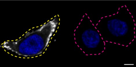 Immunocytochemistry/ Immunofluorescence - Anti-Moesin antibody [EPR2429(2)] - BSA and Azide free (AB249530), expandable thumbnail