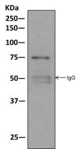 Immunoprecipitation - Anti-Moesin antibody [EPR2429(2)] - BSA and Azide free (AB249530), expandable thumbnail
