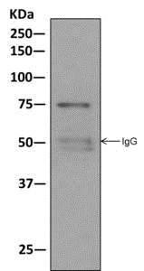Immunoprecipitation - Anti-Moesin antibody [EPR2429(2)] - BSA and Azide free (AB249530)
