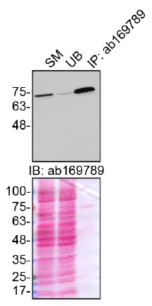 Immunoprecipitation - Anti-Moesin antibody [EPR2429(2)] - BSA and Azide free (AB249530), expandable thumbnail