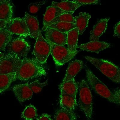 Immunocytochemistry - Anti-Moesin antibody [MSN/492] - BSA and Azide free (AB215840)