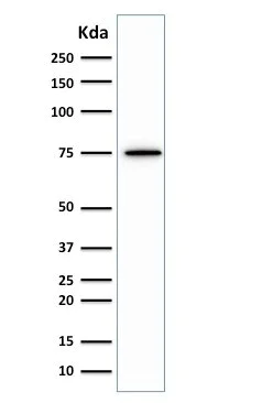 Western blot - Anti-Moesin antibody [MSN/492] - BSA and Azide free (AB215840)