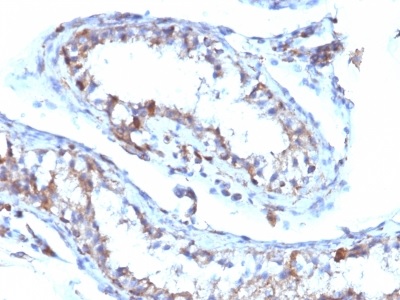 Immunohistochemistry (Formalin/PFA-fixed paraffin-embedded sections) - Anti-Moesin antibody [MSN/493] (AB233931)