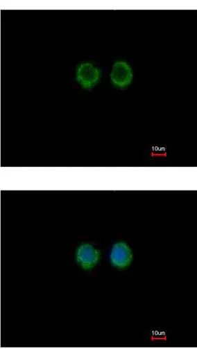 Immunocytochemistry/ Immunofluorescence - Anti-MOK protein kinase antibody (AB154759)