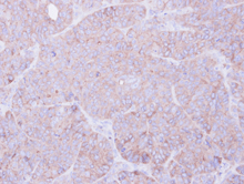 Immunohistochemistry (Formalin/PFA-fixed paraffin-embedded sections) - Anti-MOK protein kinase antibody (AB154759)
