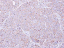 Immunohistochemistry (Formalin/PFA-fixed paraffin-embedded sections) - Anti-MOK protein kinase antibody (AB154759)