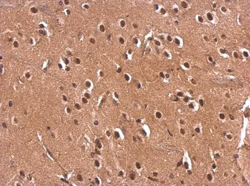 Immunohistochemistry (Formalin/PFA-fixed paraffin-embedded sections) - Anti-Monoacylglycerol Lipase/MGL antibody (AB228598)
