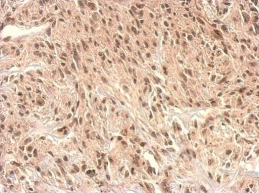 Immunohistochemistry (Formalin/PFA-fixed paraffin-embedded sections) - Anti-Monoacylglycerol Lipase/MGL antibody (AB228598)