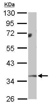 Western blot - Anti-Monoacylglycerol Lipase/MGL antibody (AB228598)