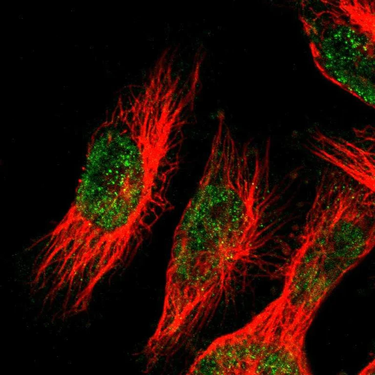 Immunocytochemistry/ Immunofluorescence - Anti-Monoacylglycerol Lipase/MGL antibody (AB246902)