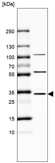 Western blot - Anti-Monoacylglycerol Lipase/MGL antibody (AB246902)