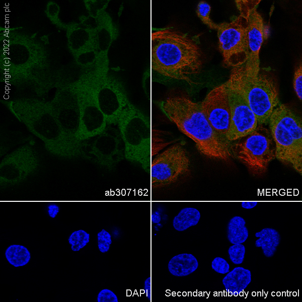 Immunocytochemistry/ Immunofluorescence - Anti-Monoacylglycerol Lipase/MGL antibody [EPR26936-12] (ab307162), expandable thumbnail