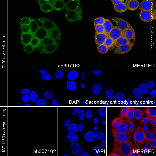 Immunocytochemistry/ Immunofluorescence - Anti-Monoacylglycerol Lipase/MGL antibody [EPR26936-12] (AB307162), expandable thumbnail