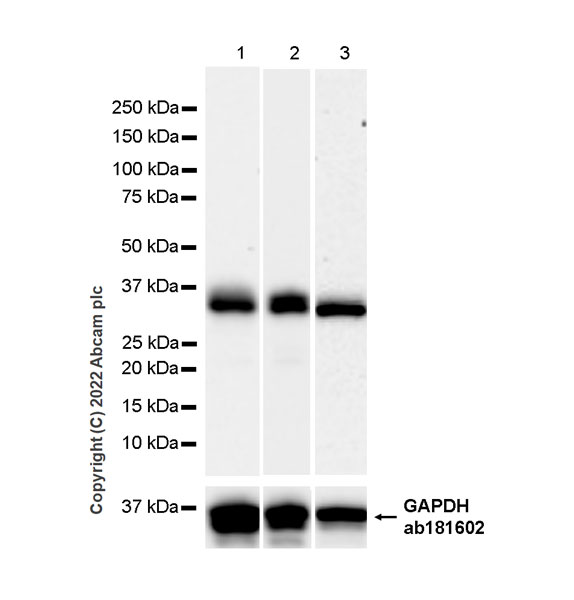 Western blot - Anti-Monoacylglycerol Lipase/MGL antibody [EPR26936-12] (ab307162), expandable thumbnail