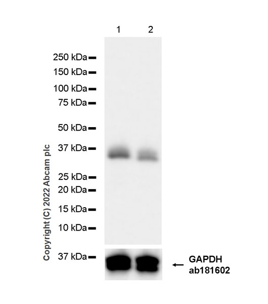 Western blot - Anti-Monoacylglycerol Lipase/MGL antibody [EPR26936-12] (ab307162), expandable thumbnail