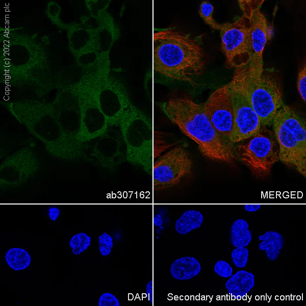 Immunocytochemistry/ Immunofluorescence - Anti-Monoacylglycerol Lipase/MGL antibody [EPR26936-12] - BSA and Azide free (AB307163)