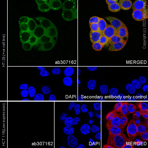 Immunocytochemistry/ Immunofluorescence - Anti-Monoacylglycerol Lipase/MGL antibody [EPR26936-12] - BSA and Azide free (AB307163)