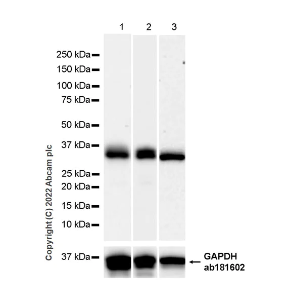 Western blot - Anti-Monoacylglycerol Lipase/MGL antibody [EPR26936-12] - BSA and Azide free (AB307163)