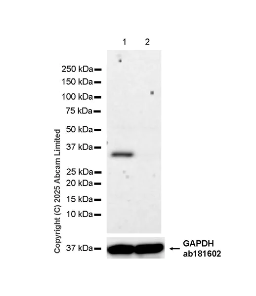 Western blot - Anti- Monoacylglycerol Lipase/MGL antibody [EPR29806-56] (AB324104)