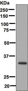 Western blot - Anti-Monoacylglycerol Lipase/MGL antibody [EPR6339] (AB124796)