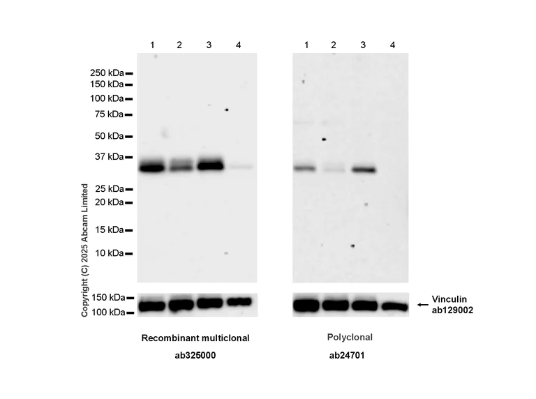 Western blot - Anti-Monoacylglycerol Lipase/MGL antibody [RM1358] (AB325000)