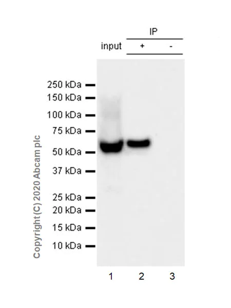 Immunoprecipitation - Anti-Monoamine Oxidase B/MAOB antibody [EPR24131-79] (AB259928)