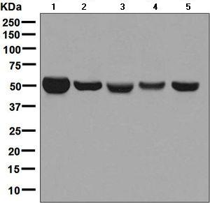 Western blot - Anti-Monoamine Oxidase B/MAOB antibody [EPR7102] - BSA and Azide free (AB248436), expandable thumbnail