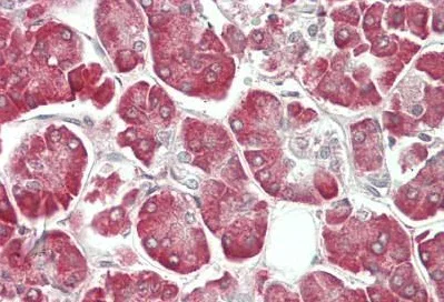 Immunohistochemistry (Formalin/PFA-fixed paraffin-embedded sections) - Anti-MORC3 antibody (AB230878)