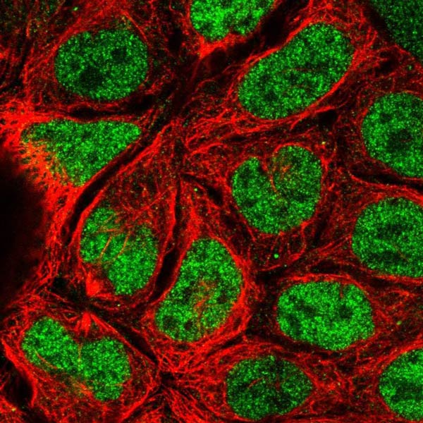 Immunocytochemistry/ Immunofluorescence - Anti-MORC4 antibody (AB121099)