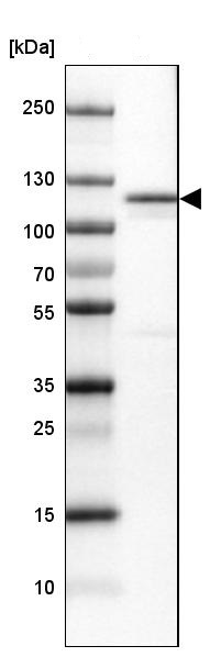 Western blot - Anti-MORC4 antibody (AB121099)