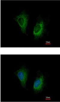 Immunocytochemistry/ Immunofluorescence - Anti-MOSC2 antibody (AB111685), expandable thumbnail