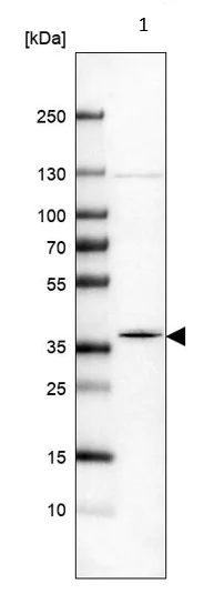 Western blot - Anti-MOSC2 antibody (AB224097)