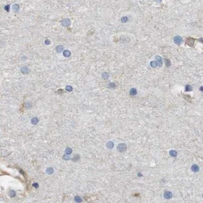 Immunohistochemistry (Formalin/PFA-fixed paraffin-embedded sections) - Anti-MOSC2 antibody (AB224398)