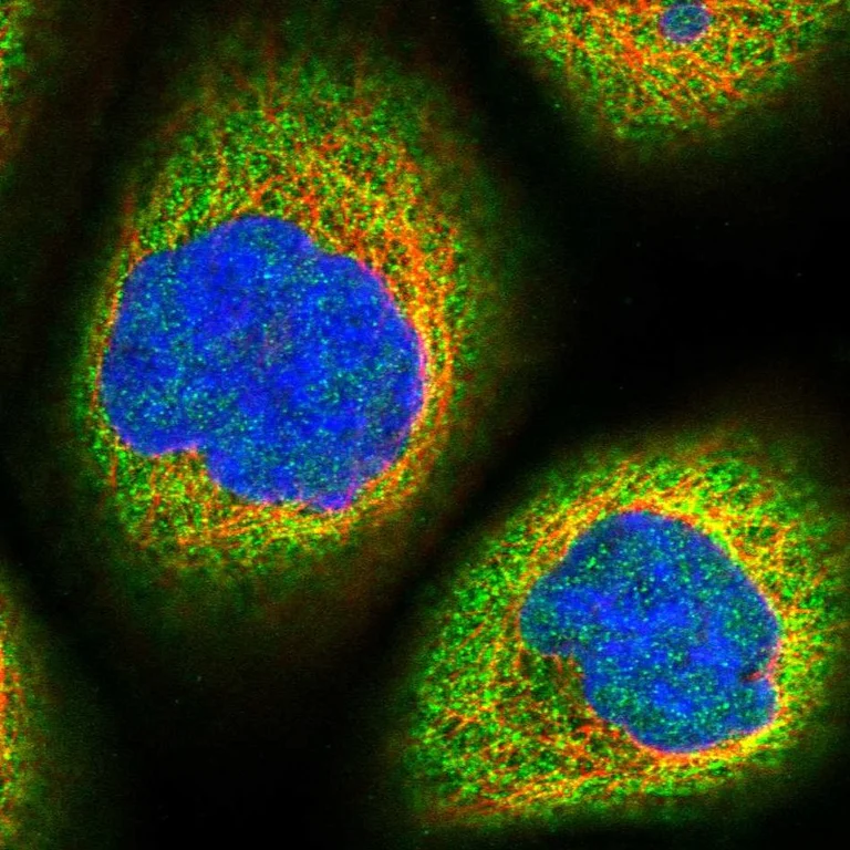 Immunocytochemistry/ Immunofluorescence - Anti-MOSPD3 antibody (AB272635)