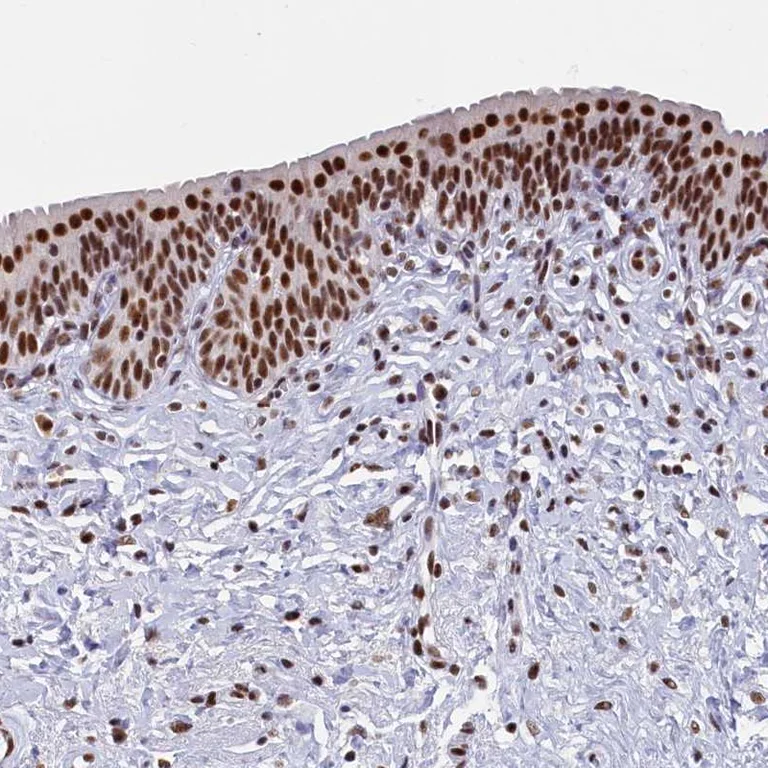 Immunohistochemistry (Formalin/PFA-fixed paraffin-embedded sections) - Anti-MOSPD3 antibody (AB272635)