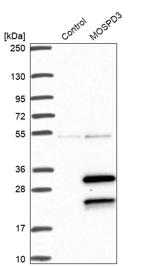 Western blot - Anti-MOSPD3 antibody (AB272635)
