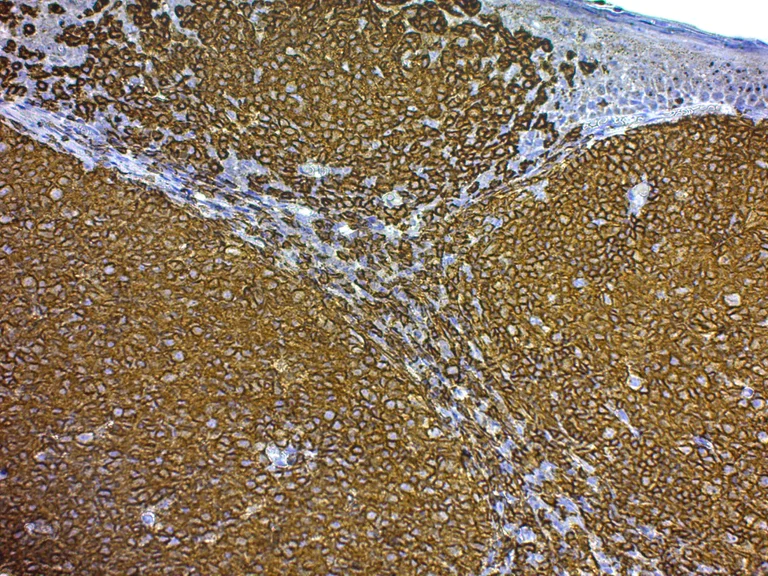 Immunohistochemistry (Formalin/PFA-fixed paraffin-embedded sections) - Mounting Medium for IHC - Aqueous (AB64230)