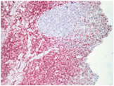 Immunohistochemistry (Formalin/PFA-fixed paraffin-embedded sections) - Mouse and Rabbit Specific HRP/AEC Detection IHC Kit (AB93705), expandable thumbnail