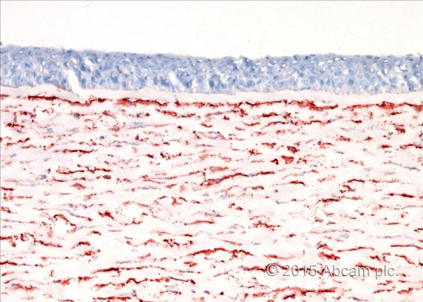 Immunohistochemistry (Frozen sections) - Mouse and Rabbit Specific HRP/AEC Detection IHC Kit (AB93705), expandable thumbnail
