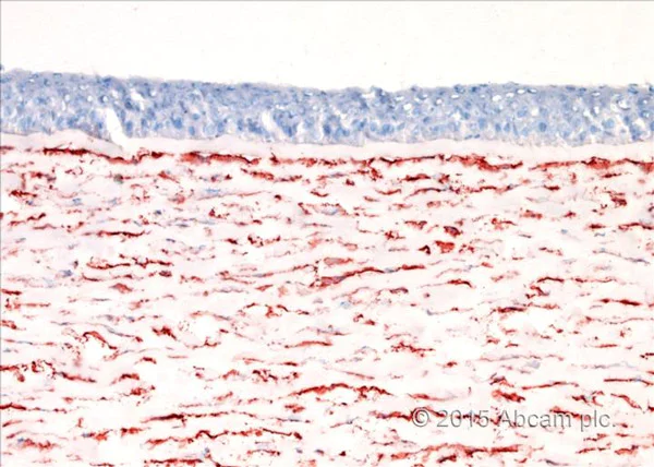 Immunohistochemistry (Frozen sections) - Mouse and Rabbit Specific HRP/AEC Detection IHC Kit (AB93705)