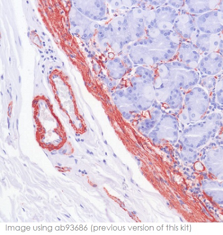 Immunohistochemistry (Formalin/PFA-fixed paraffin-embedded sections) - Mouse and Rabbit Specific HRP/AEC IHC Detection Kit - Micro-polymer (AB236467), expandable thumbnail