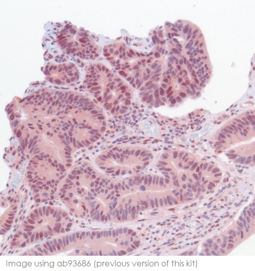 Immunohistochemistry (Formalin/PFA-fixed paraffin-embedded sections) - Mouse and Rabbit Specific HRP/AEC IHC Detection Kit - Micro-polymer (AB236467), expandable thumbnail