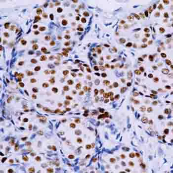 Immunohistochemistry (Formalin/PFA-fixed paraffin-embedded sections) - Mouse and Rabbit Specific HRP/DAB Detection IHC kit (AB64264)