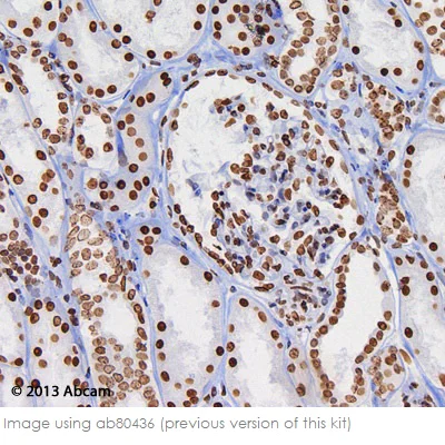 Immunohistochemistry (Formalin/PFA-fixed paraffin-embedded sections) - Mouse and Rabbit Specific HRP/DAB IHC Detection Kit - Micro-polymer (AB236466)