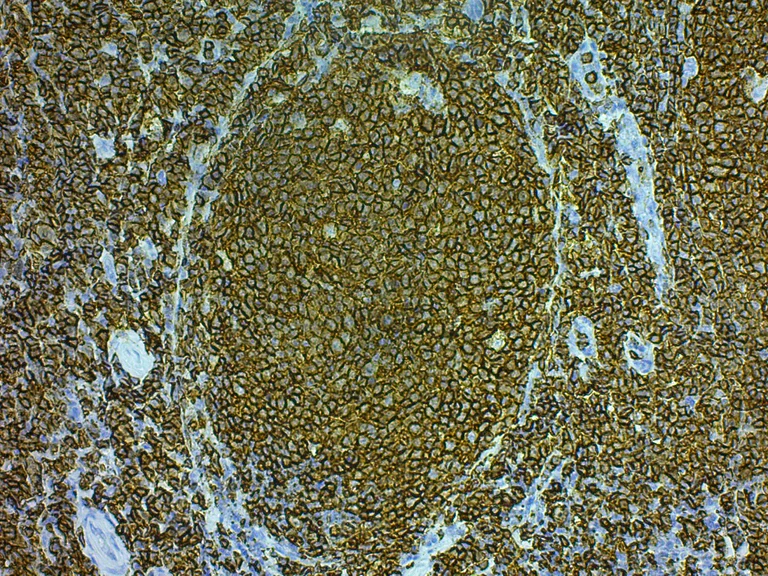 Immunohistochemistry (Formalin/PFA-fixed paraffin-embedded sections) - Mouse and Rabbit Specific HRP/DAB IHC Detection Kit - Micro-polymer (AB236466)