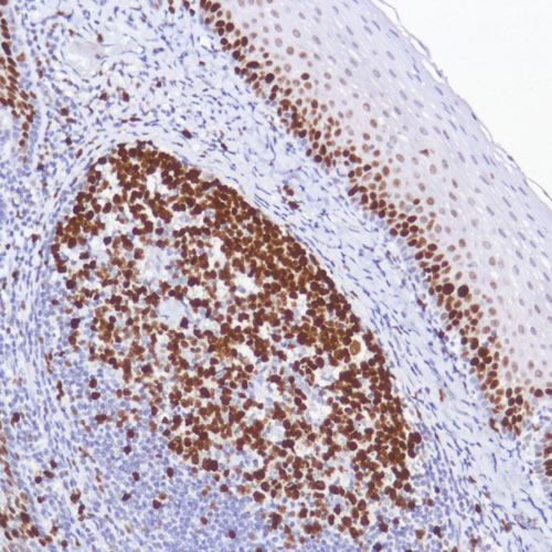 Immunohistochemistry (Formalin/PFA-fixed paraffin-embedded sections) - Mouse and Rabbit Specific HRP Detection IHC Kit (AB93677), expandable thumbnail