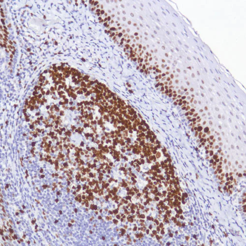 Immunohistochemistry (Formalin/PFA-fixed paraffin-embedded sections) - Mouse and Rabbit Specific HRP Detection IHC Kit (AB93677)